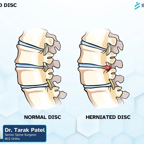 Indospine Hospital photo
