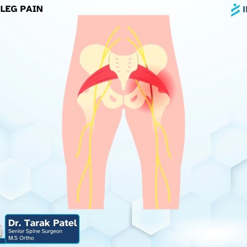 Indospine Hospital photo